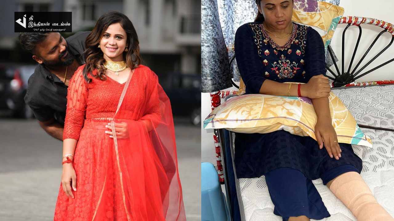 படுத்த படுக்கையில் மணிமேகலை…குக் வித் கோமாளி மணிமேகலைக்கு நடந்த சோகம்… காலில் கட்டுடன் அவரே வெளியிட்ட புகைப்படம்