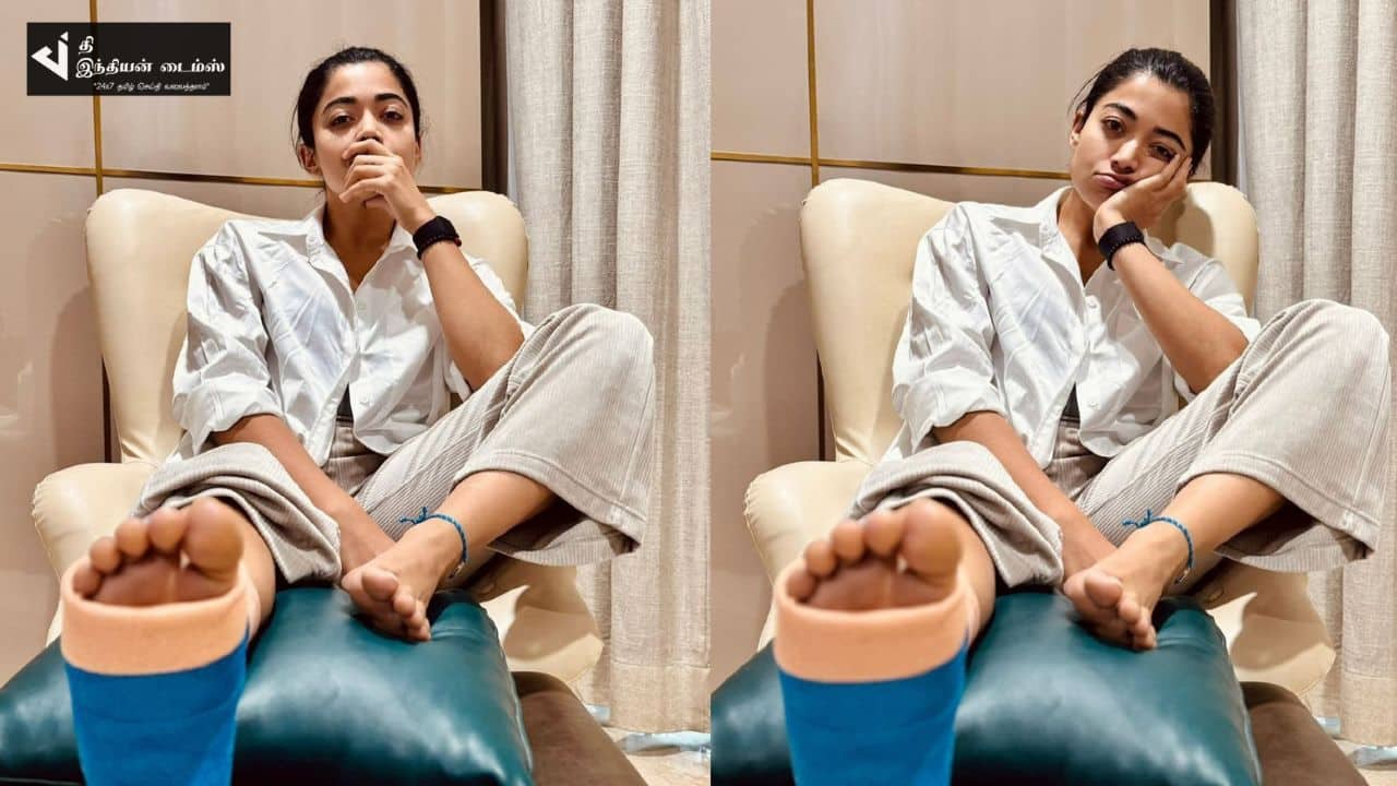 காலில் கட்டுடன் நடிகை ரஷ்மிக்கா மந்தன்னா